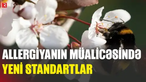 Allergiyanın müalicəsində yeni standartlar - RTV