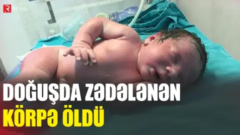 Doğuşda zədə alan körpə 5 gün sonra öldü - RTV