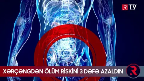 Xərçəngdən ölüm riskini 3 dəfə azaltmağın yolları açıqlandı - RTV