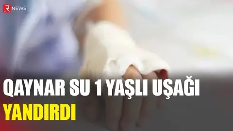 Cəlilabadda qaynar su 1 yaşlı uşağı yandırdı - RTV