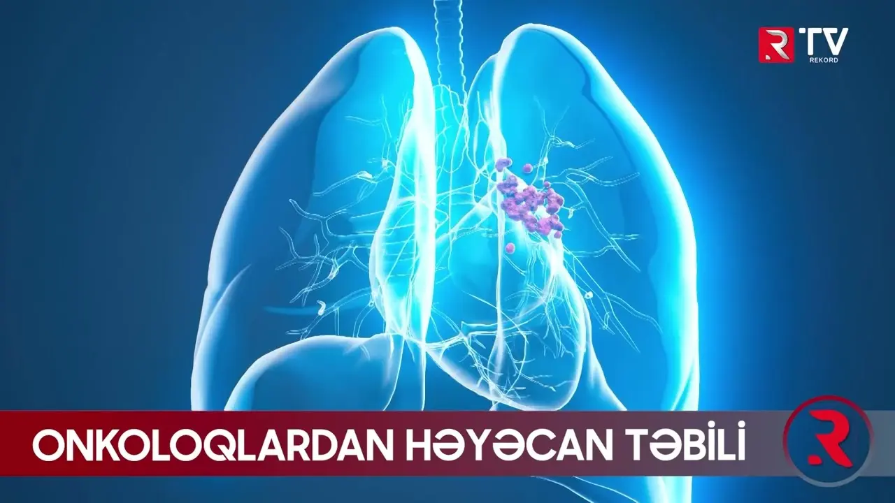 Onkoloqlardan ÇAĞIRIŞ: evdə istifadə olunan bu vasitədən dərhal imtina edin - RTV