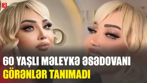 60 yaşlı Məleykə Əsədovanı görənlər TANIMADI - RTV