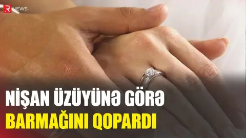 Qadın nişan üzüyünə görə barmağını qopardı - RTV