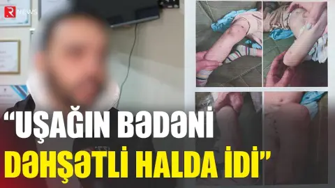 “Uşağın bədənin görəndə şoka düşdüm” - Bakıdakı dəhşətli hadisənin TƏFƏRRÜATI  - RTV