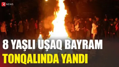 Bayram tonqalında 8 yaşlı uşaq yandı - RTV